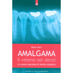 Amalgama: Il Veleno Nei DentiLa cuasa nascosta di molte malattie