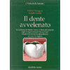 Il Dente Avvelenato<br />